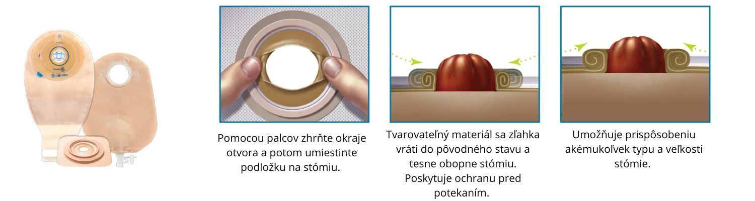 Nepravidelný tvar stómie - obrázok webovej stránky