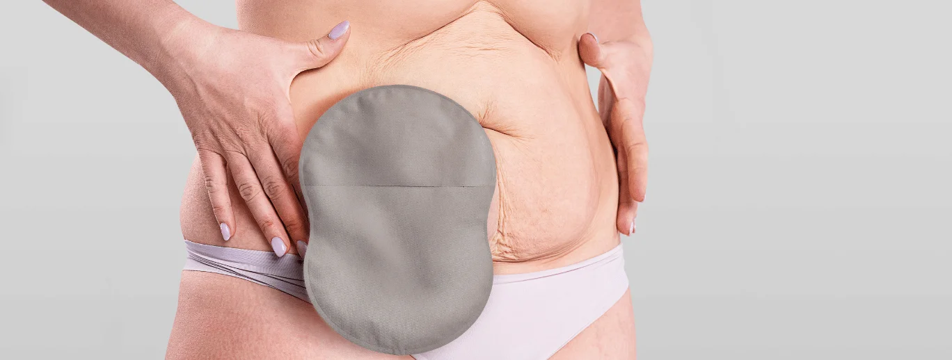 Barriera cutanea per stomia Convatec con adesivi Gold Standard, progettata per la protezione della pelle, con apertura del coperchio a metà superiore.